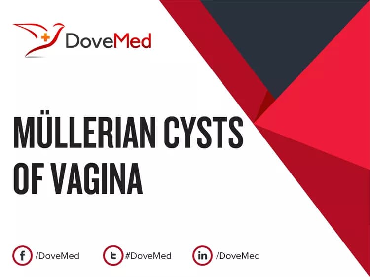 Müllerian Cysts of Vagina