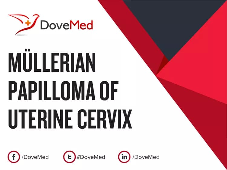 Müllerian Papilloma of Uterine Cervix