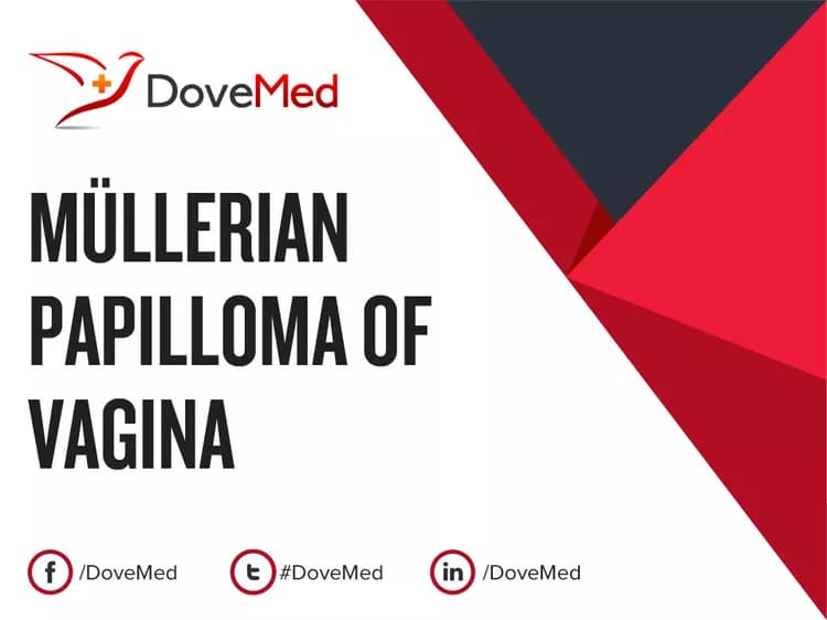 Can you access healthcare professionals in your community to manage Müllerian Papilloma of Vagina?