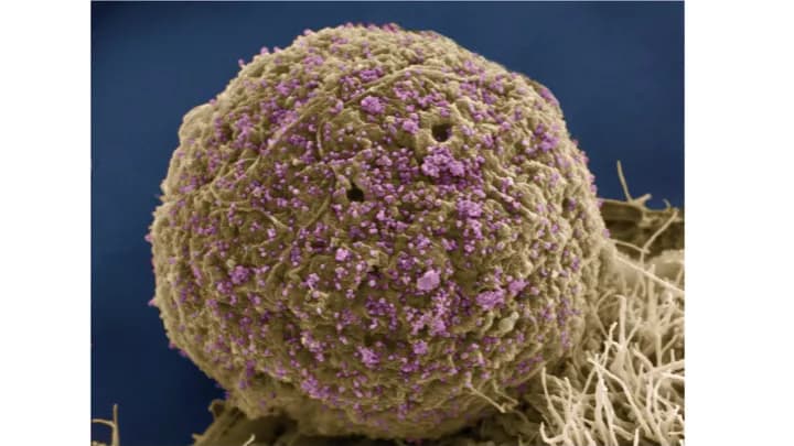 Mark Ellisman and Tom Deerinck, National Center for Microscopy and Imaging Research