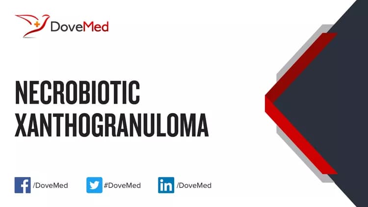 Can you access healthcare professionals in your community to manage Necrobiotic Xanthogranuloma?