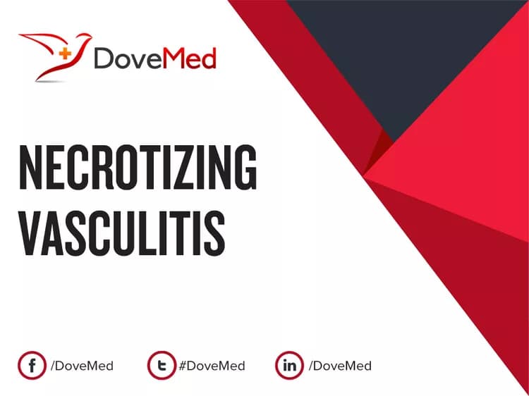 Are you satisfied with the quality of care to manage Necrotizing Vasculitis in your community?