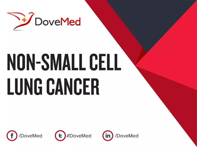 Are you satisfied with the quality of care to manage Non-Small Cell Lung Cancer in your community?