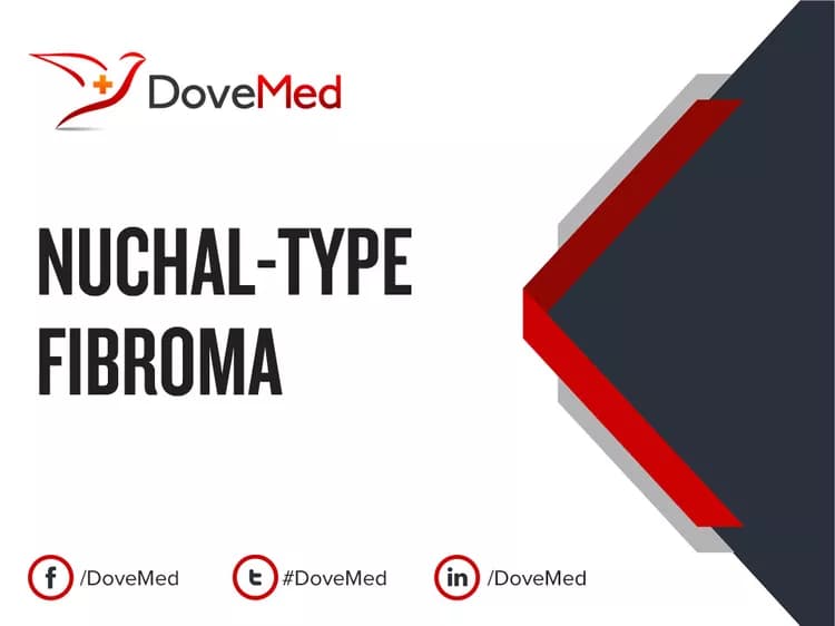 Can you access healthcare professionals in your community to manage Nuchal-Type Fibroma?