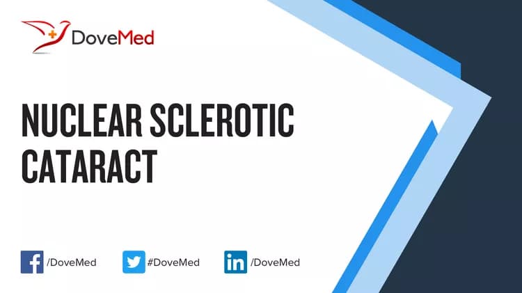 How well do you know Nuclear Sclerotic Cataract?