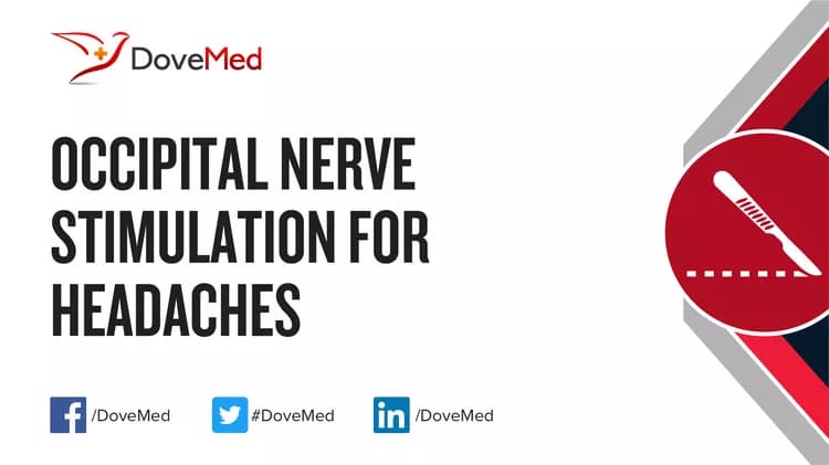 Occipital Nerve Stimulation for Headaches