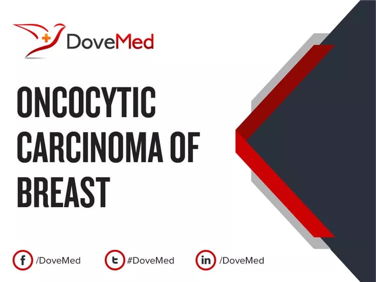 Are you satisfied with the quality of care to manage Oncocytic Carcinoma of Breast in your community?