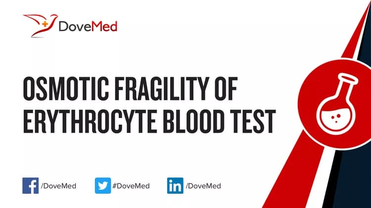 Osmotic Fragility of Erythrocyte Blood Test