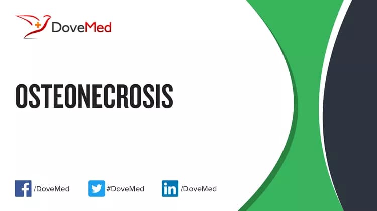 Are you satisfied with the quality of care to manage Osteonecrosis in your community?