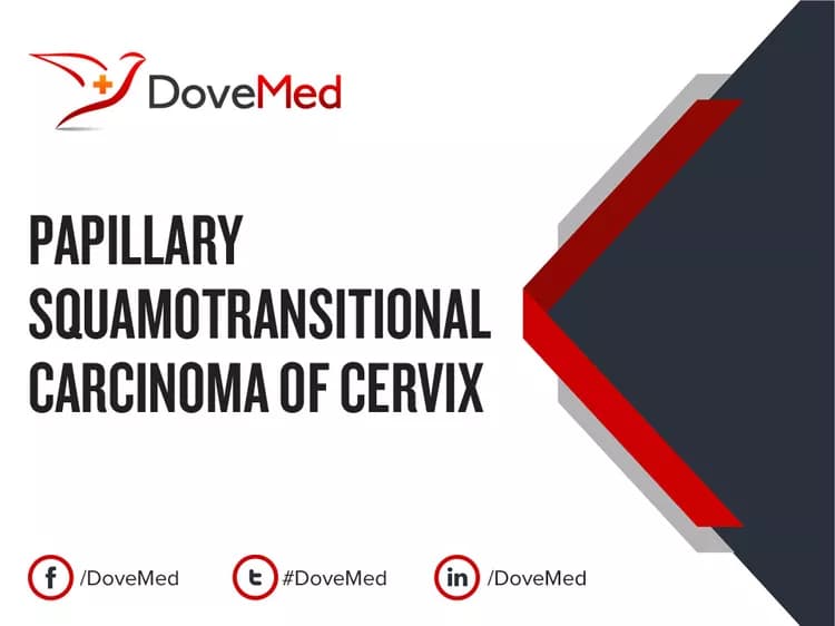 Papillary Squamotransitional Carcinoma of Cervix