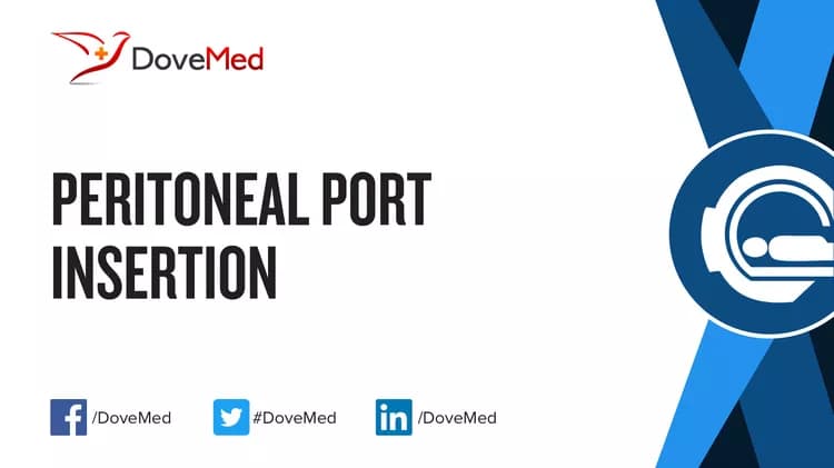 Peritoneal Port Insertion