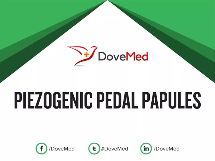 Is the cost to manage Piezogenic Pedal Papules in your community affordable?