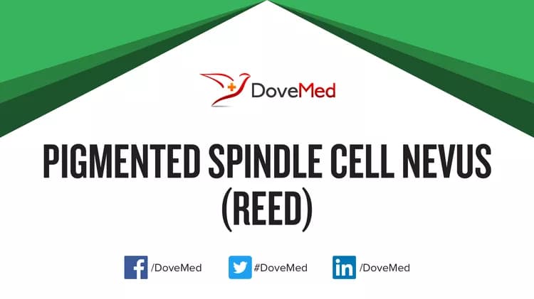 Can you access healthcare professionals in your community to manage Pigmented Spindle Cell Nevus (Reed)?