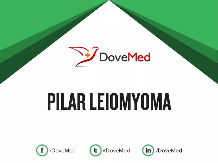 Can you access healthcare professionals in your community to manage Pilar Leiomyoma?