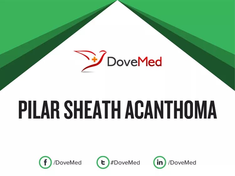 Can you access healthcare professionals in your community to manage Pilar Sheath Acanthoma?