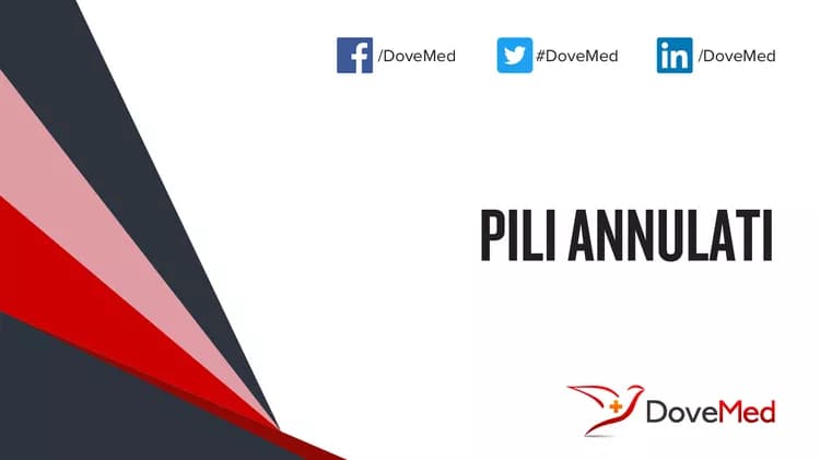 Can you access healthcare professionals in your community to manage Pili Annulati?