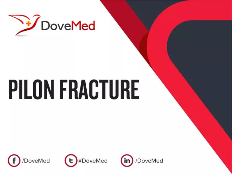 How well do you know Pilon Fracture?
