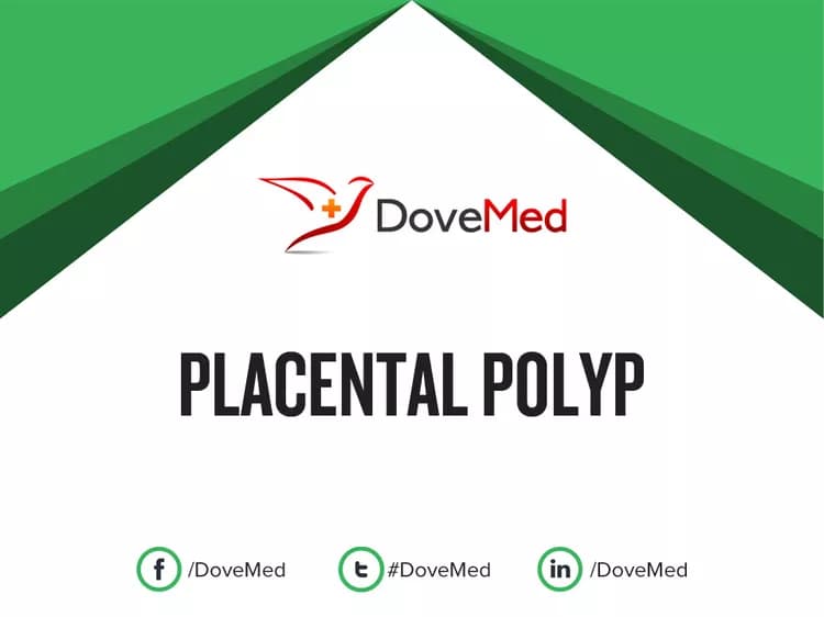 Can you access healthcare professionals in your community to manage Placental Polyp?