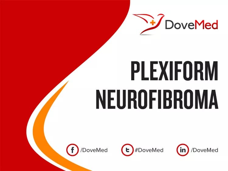 Plexiform Neurofibroma