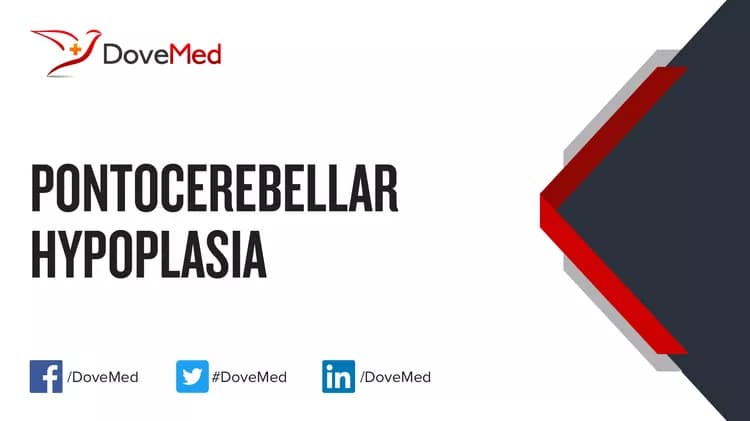 Can you access healthcare professionals in your community to manage Pontocerebellar Hypoplasia?