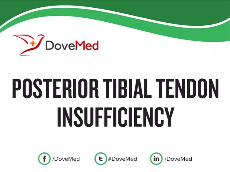 Posterior Tibial Tendon Insufficiency (PTTI)