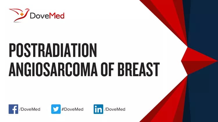 Postradiation Angiosarcoma of Breast