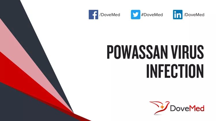 How well do you know Powassan Virus Infection?