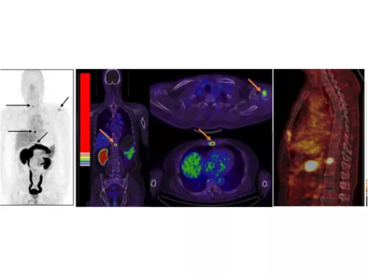 Jingjing Zhang, Peking Union Medical College, Beijing, China.