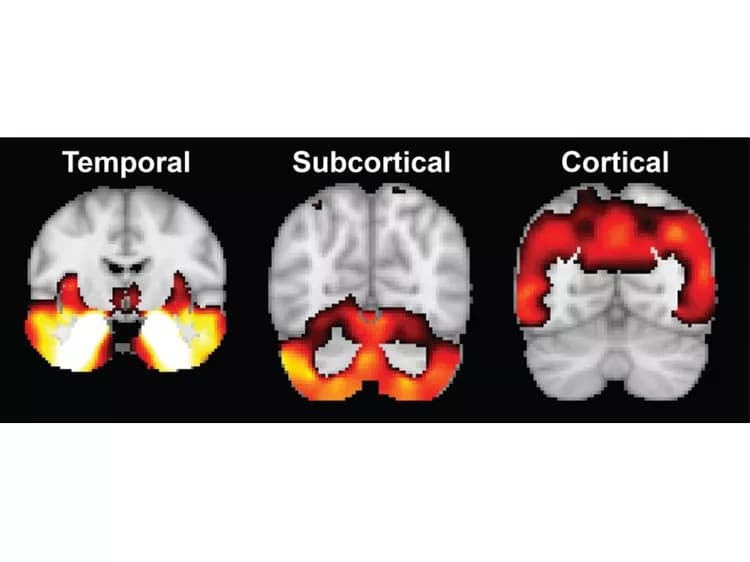Xiuming Zhang, National University of Singapore