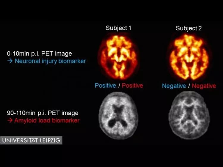 Henryk Barthel et al., University Hospital Leipzig, Leipzig, Germany