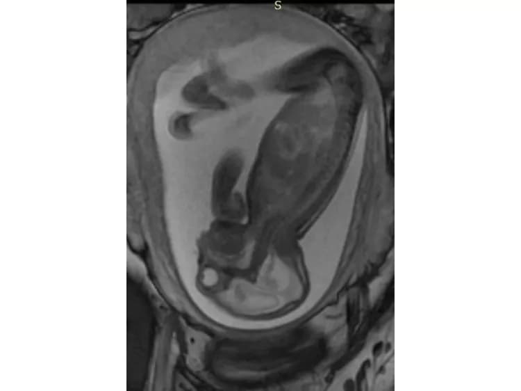 Radiological Society of North America