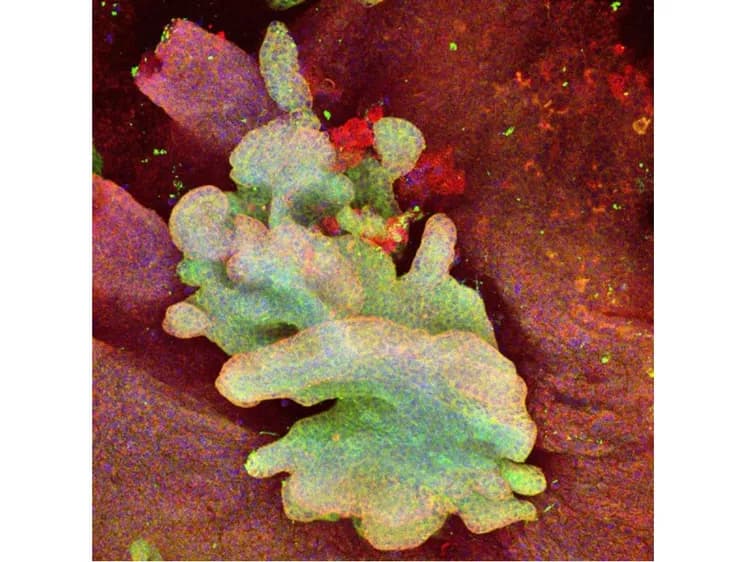 Adriana Sánchez-Danés