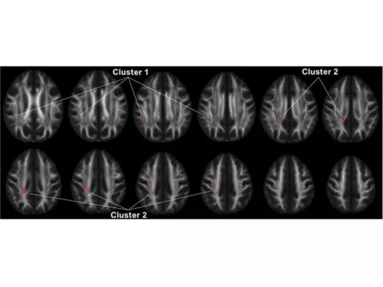 Lee, et al, Neuropsychopharmacology