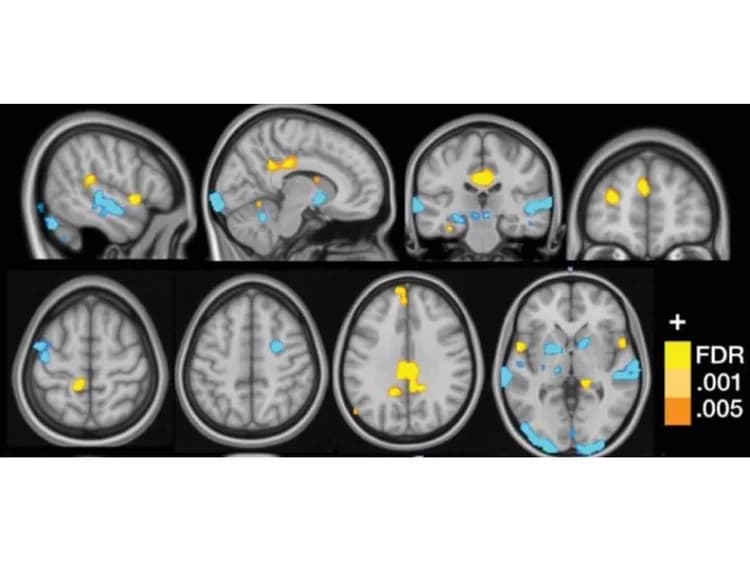 Cognitive and Affective Control Laboratory / University of Colorado Boulder