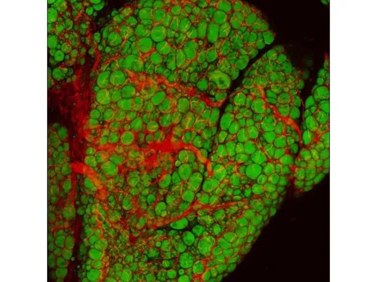 The laboratory of Zoltan Arany, MD, PhD, Perelman School of Medicine, University of PennsylvaniaClose