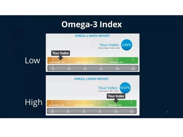 William S. Harris, PHD