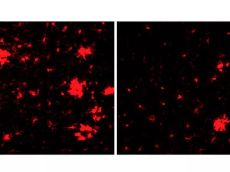 Rockefeller University