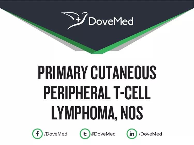 Is the cost to manage Primary Cutaneous Peripheral T-Cell Lymphoma, NOS in your community affordable?