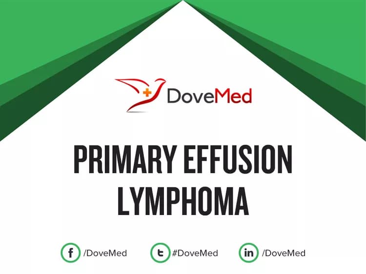 Can you access healthcare professionals in your community to manage Primary Effusion Lymphoma?