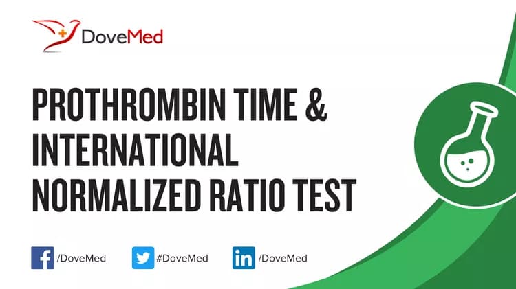 Prothrombin Time & International Normalized Ratio Test