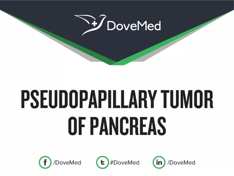 What are the treatment options for Pseudopapillary Tumor of Pancreas?