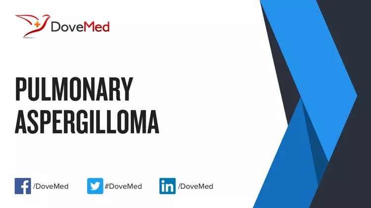 Can you access healthcare professionals in your community to manage Pulmonary Aspergilloma?