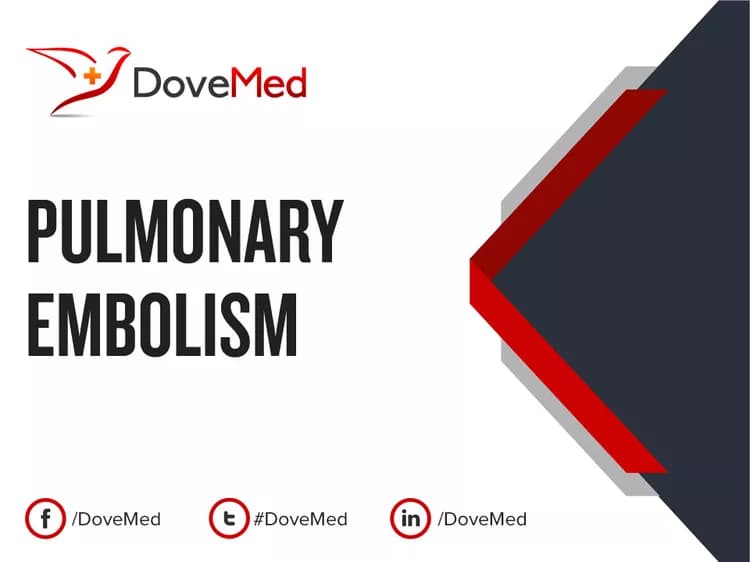 Can you access healthcare professionals in your community to manage Pulmonary Embolism?