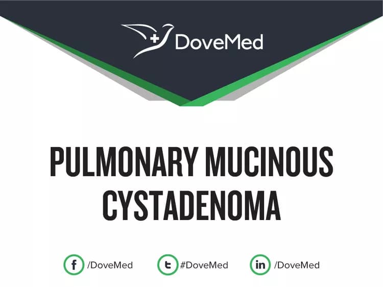 Can you access healthcare professionals in your community to manage Pulmonary Mucinous Cystadenoma?