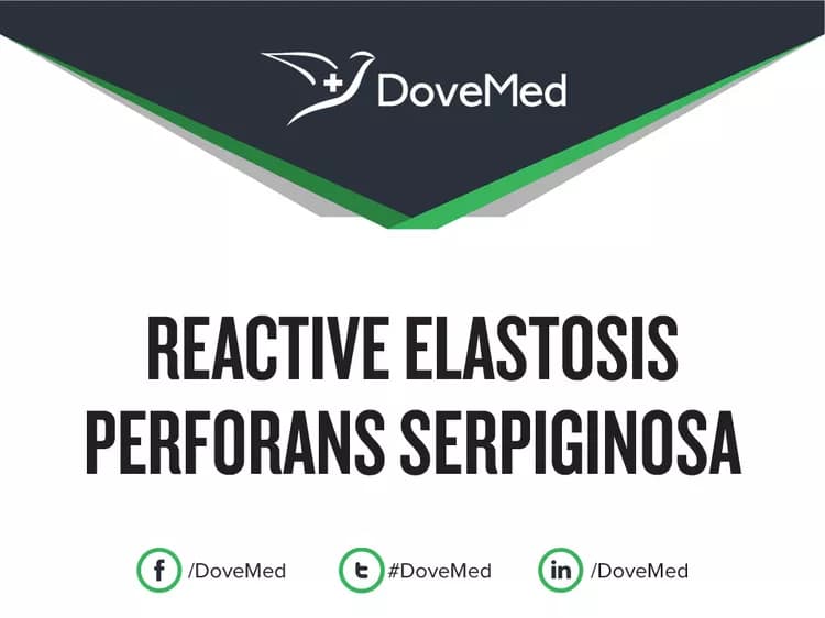 Reactive Elastosis Perforans Serpiginosa