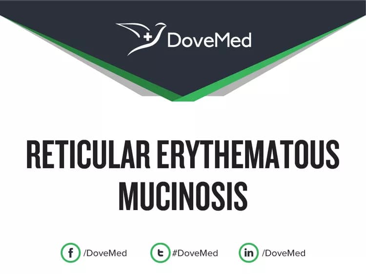 Is the cost to manage Reticular Erythematous Mucinosis in your community affordable?