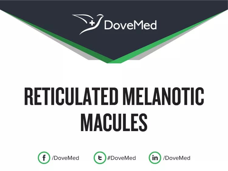Can you access healthcare professionals in your community to manage Reticulated Melanotic Macules?