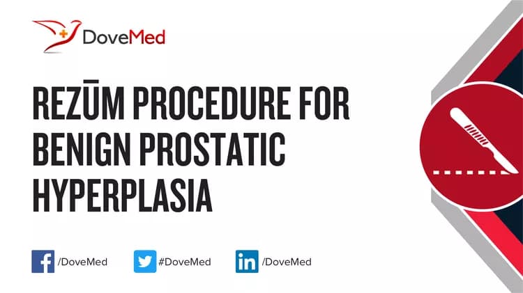 Rezum Procedure for Benign Prostatic Hyperplasia