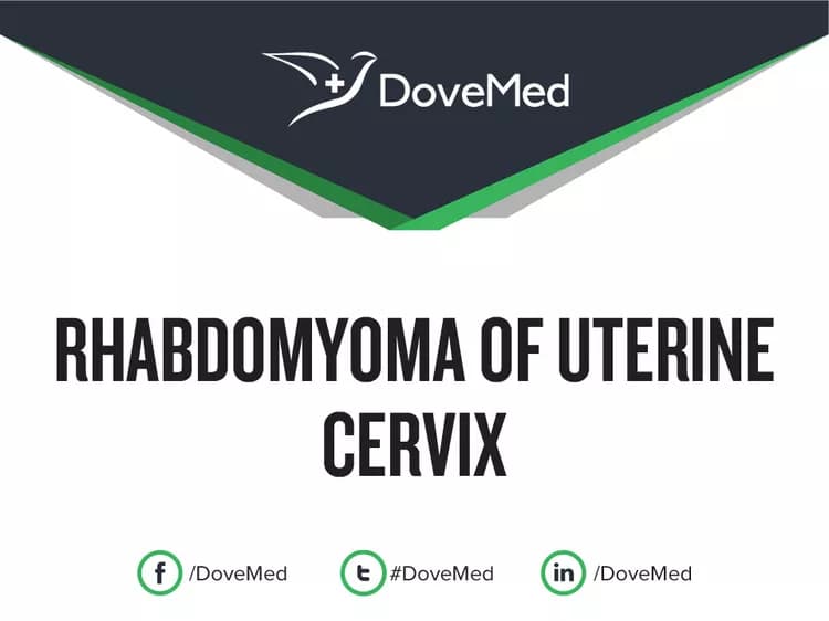 Can you access healthcare professionals in your community to manage Rhabdomyoma of Uterine Cervix?