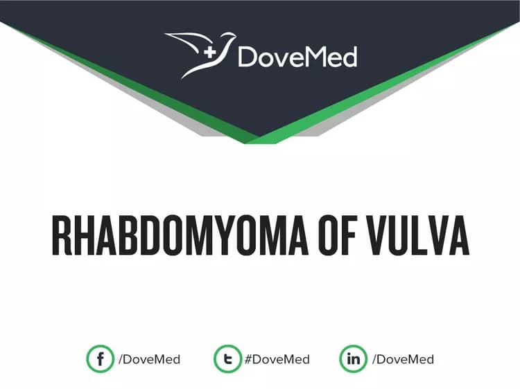 Can you access healthcare professionals in your community to manage Rhabdomyoma of Vulva?